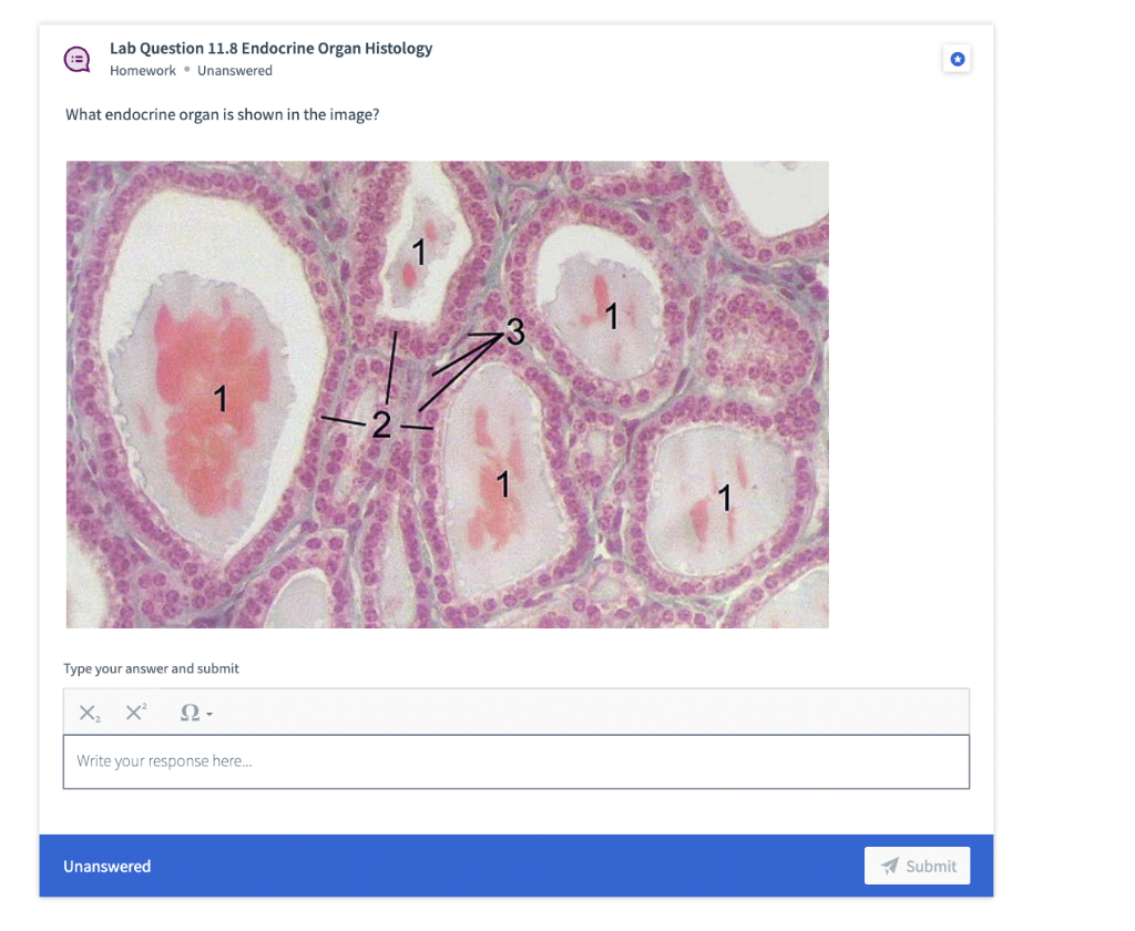 Solved Lab Question 11.8 Endocrine Organ Histology Homework. | Chegg.com