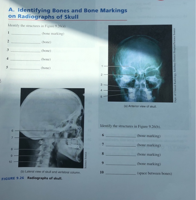 Solved A. Identifying Bones and Bone Markings on Radiographs