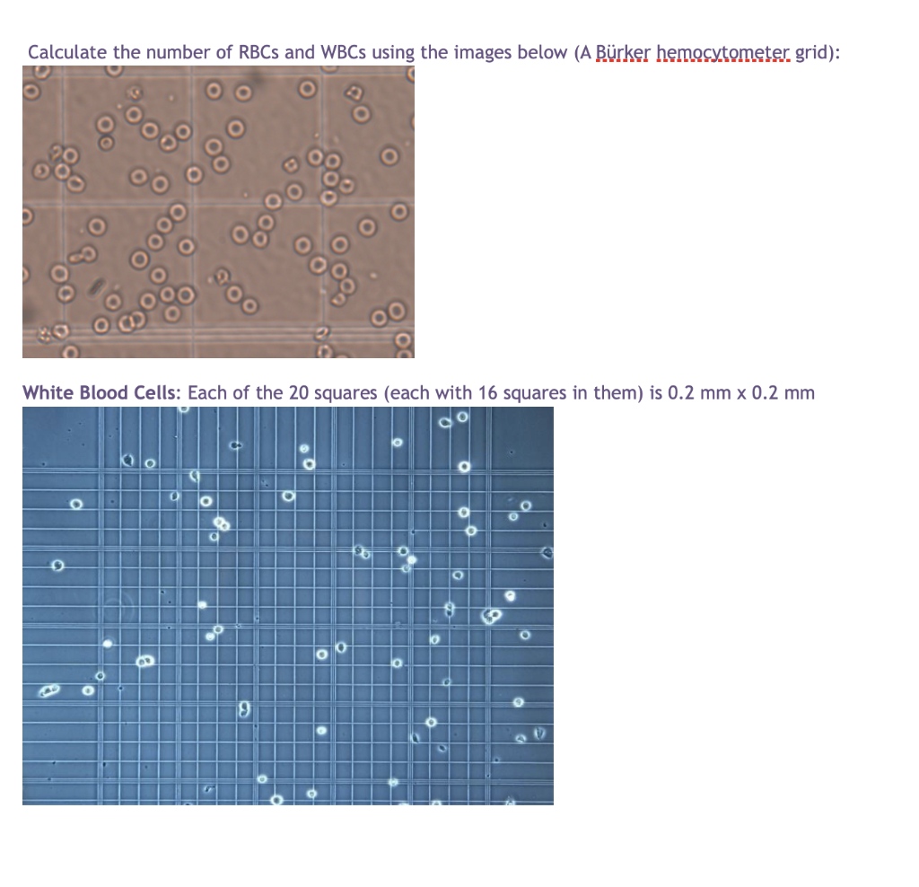 solved-calculate-the-number-of-rbcs-and-wbcs-using-the-chegg