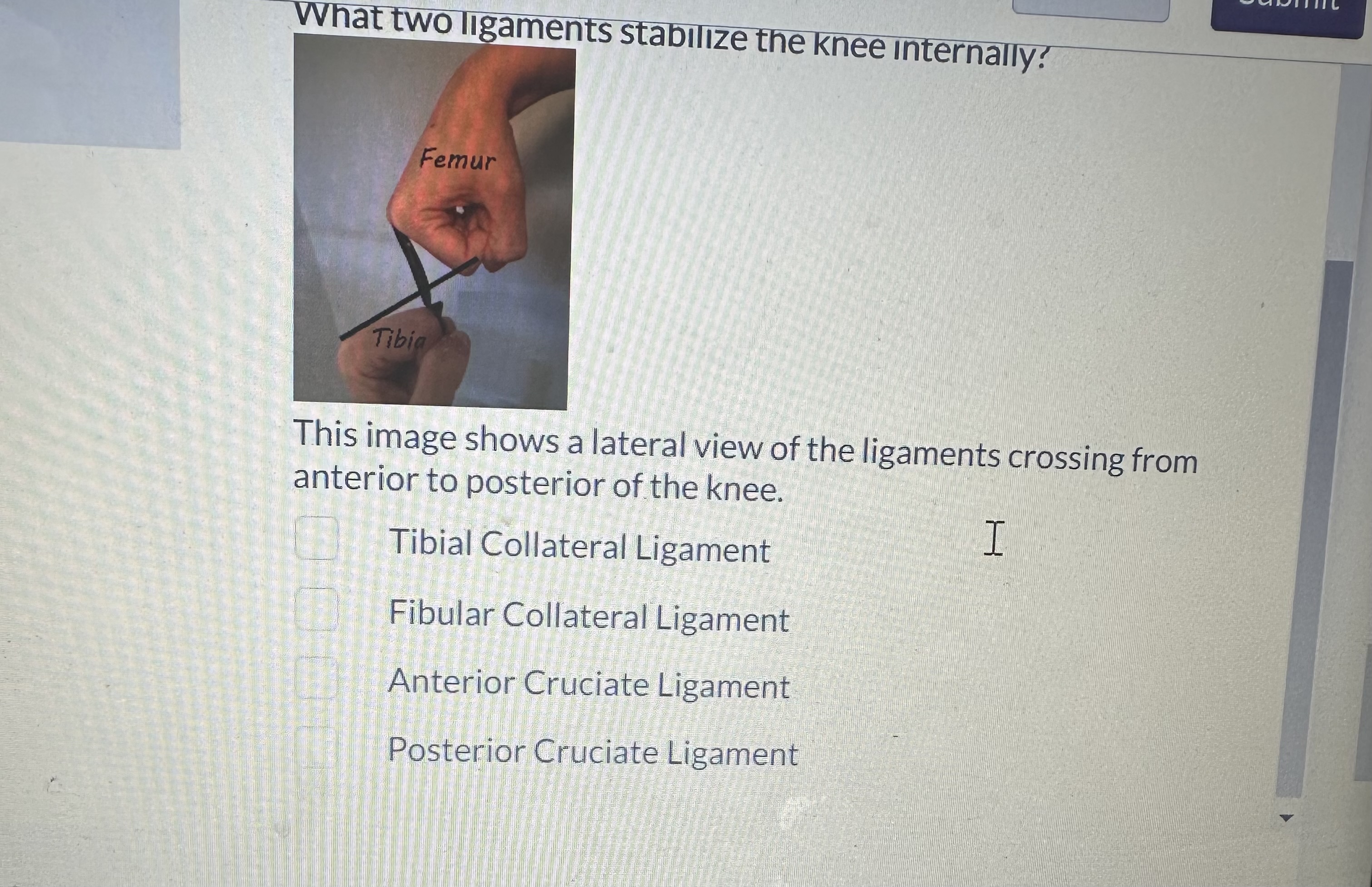 Solved What two ligaments stabilize the knee internally? | Chegg.com
