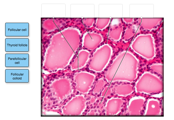 Solved Follicular cell Thyroid follicle Parafollicular cell | Chegg.com