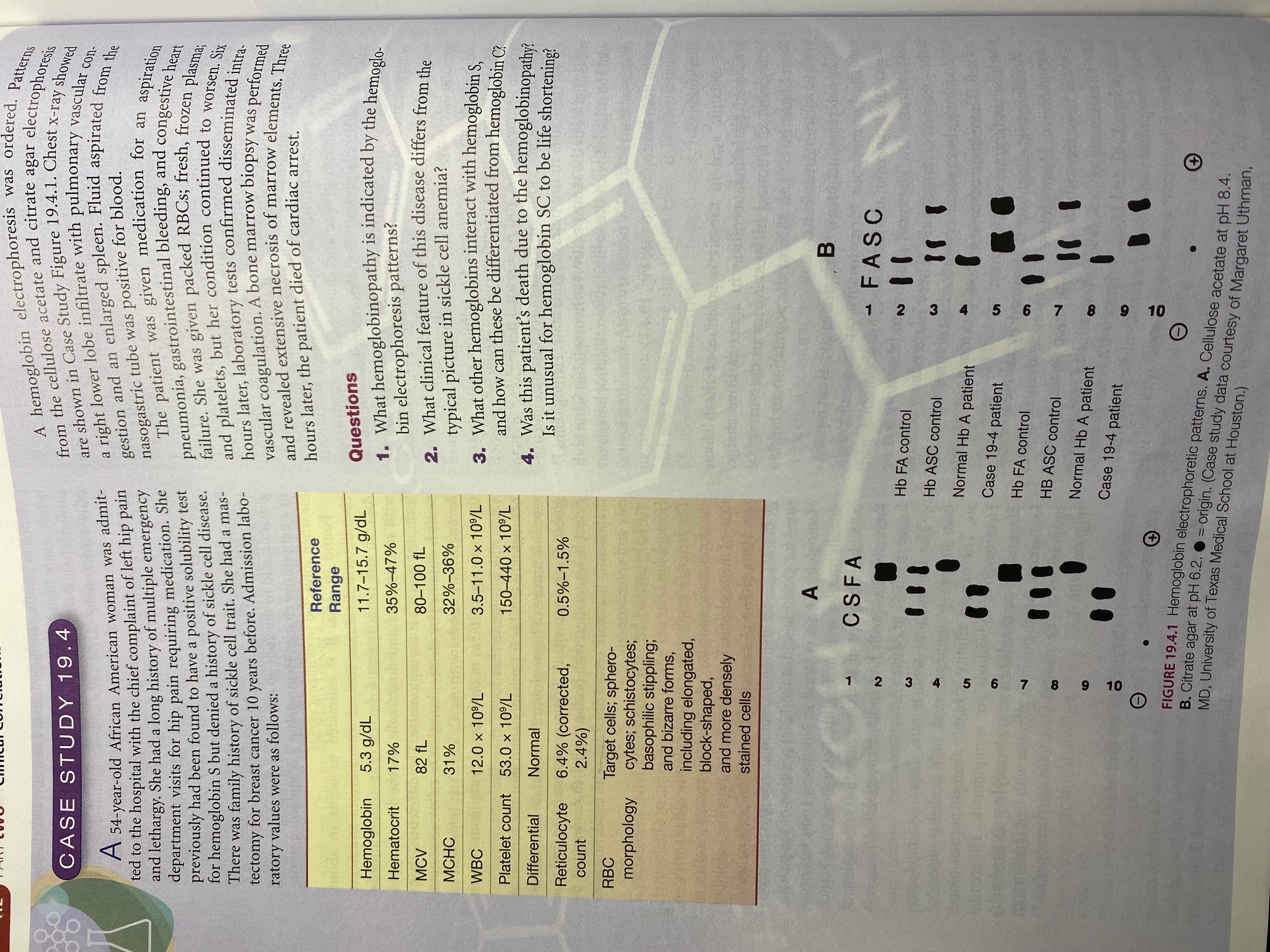 A Hemoglobin Electrophoresis Was Ordered Patterns Chegg Com   PhpgP6u54