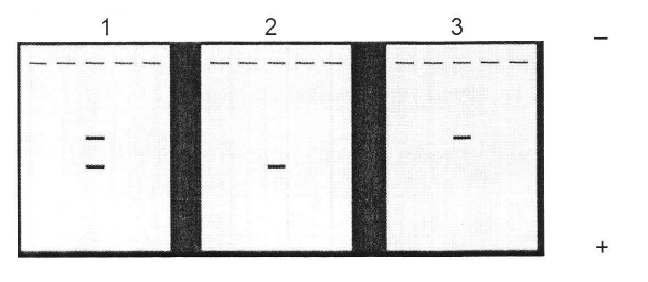 Solved 1)The SBE1 gene in peas codes for “Starch Branching | Chegg.com