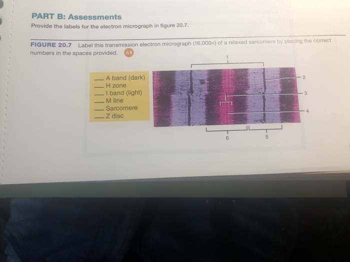 Skeletal Muscle Structure And Function Lab 19