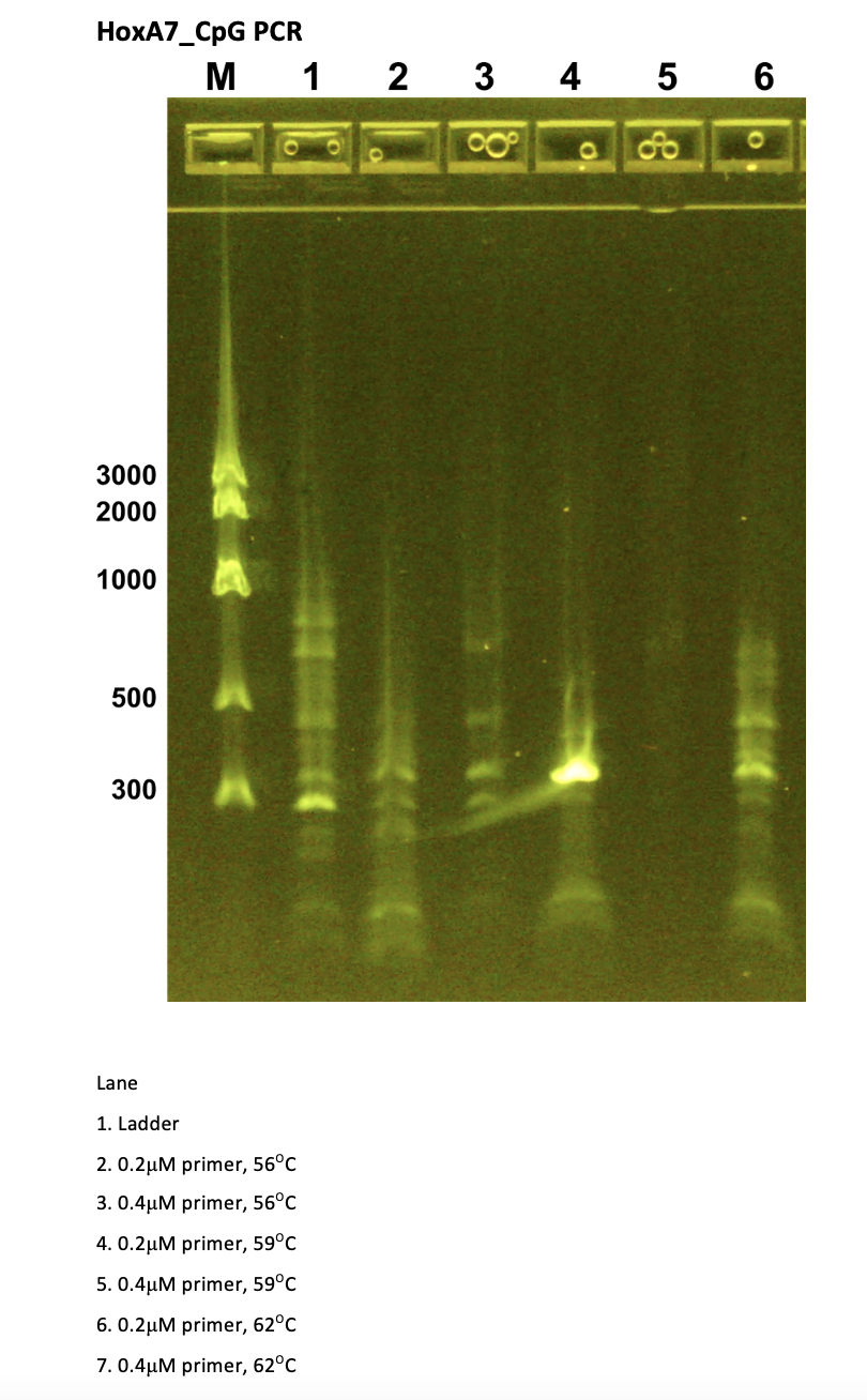 Solved Lane 1. Ladder 2. 0.2μM primer, 56∘C 3. 0.4μM primer, | Chegg.com