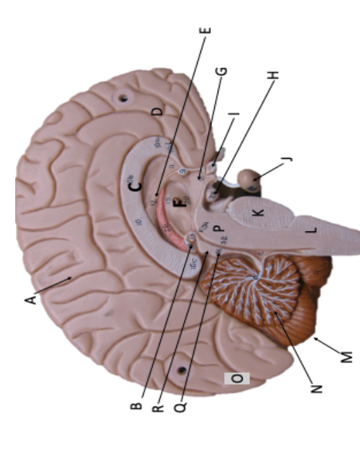 Solved Indentify the names of this brain | Chegg.com