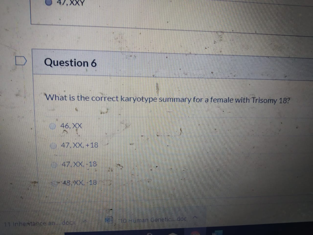 Solved Question 3 1 pts Which of the following genetic | Chegg.com