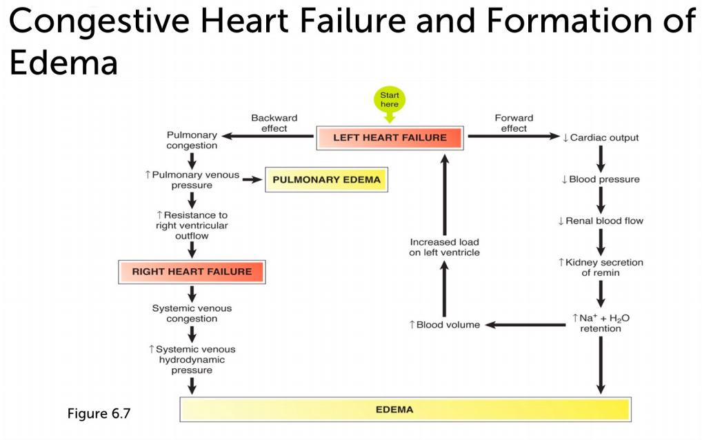 Heart Failure Pulmonary Edema