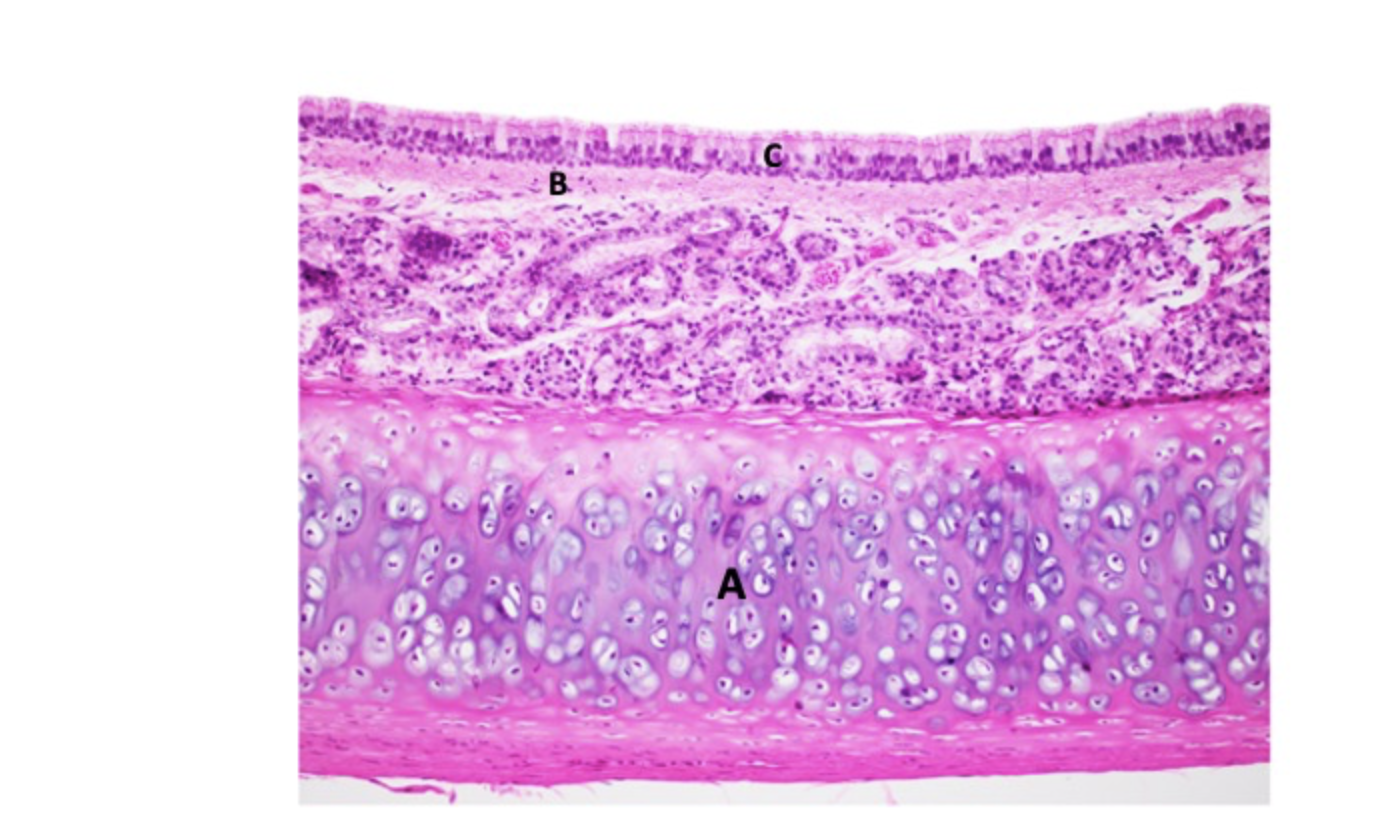 Solved This image is from the trachea. What type of tissue | Chegg.com