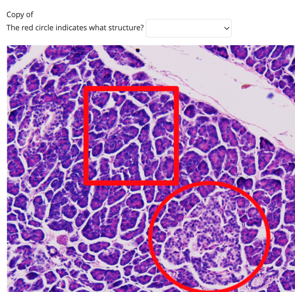 solved-copy-of-the-red-circle-indicates-what-structure-chegg