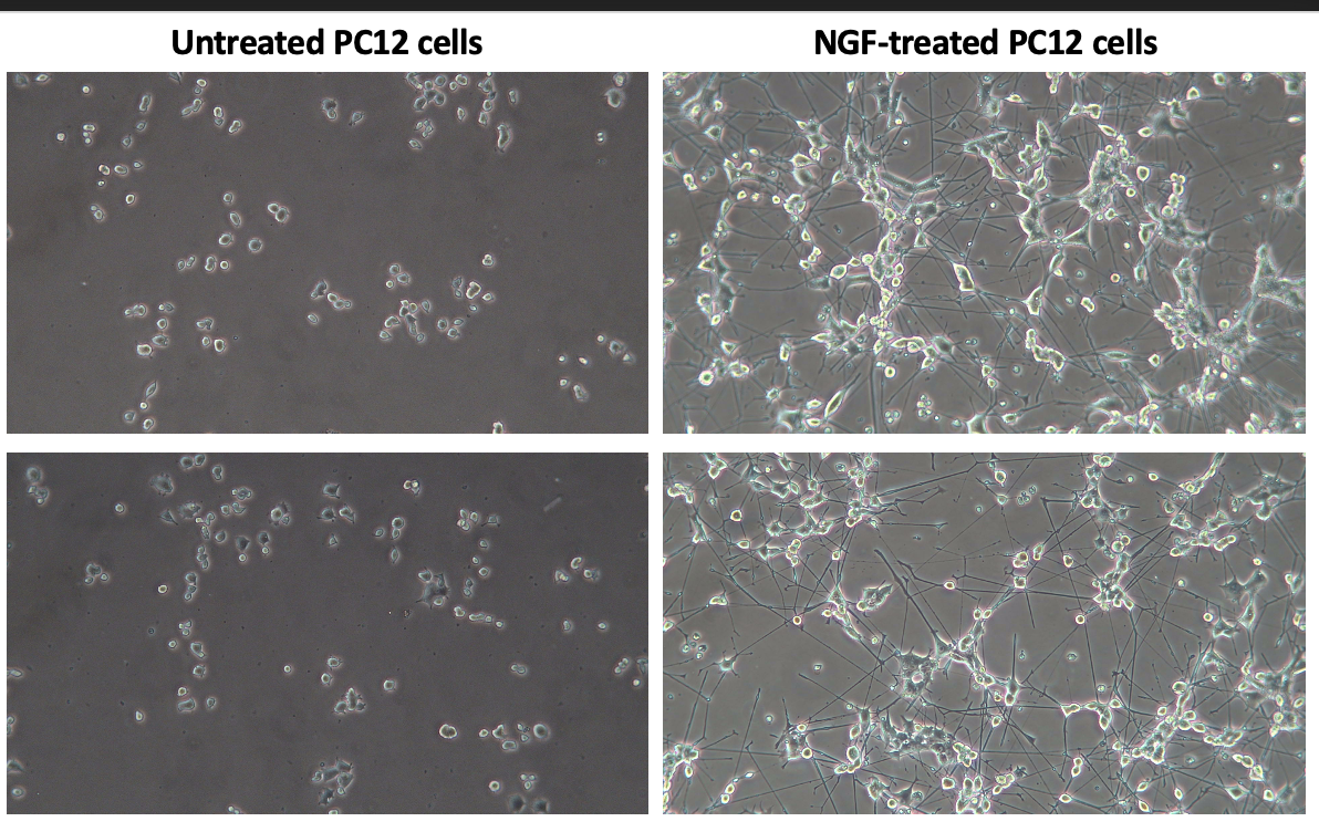 Effect of TCDD on NFL expression in NGF-treated PC12 cells. (A)