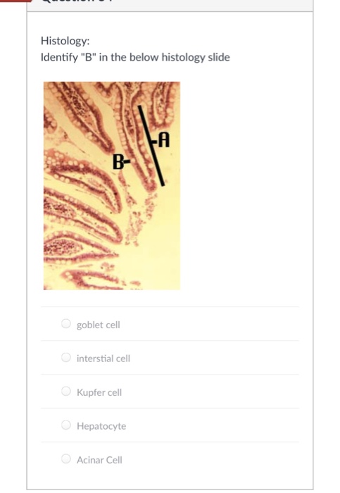 Solved Histology: Identify "B" In The Below Histology Slide | Chegg.com