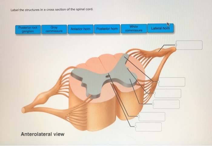 solved-label-the-structures-in-a-cross-section-of-the-spinal-chegg