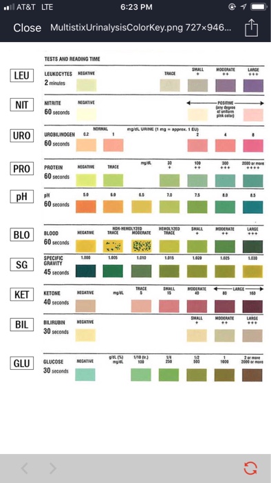 Urinary Analysis Background The Excretory System I... | Chegg.com