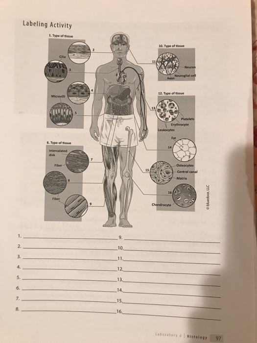 Solved Labeling Activity 1. Type of tissue 10. Type of | Chegg.com