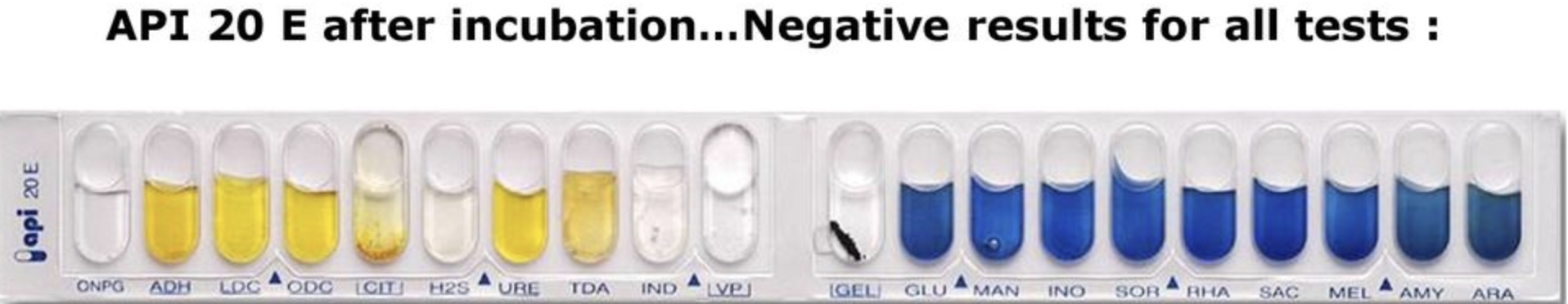 Solved Find all 3 unknowns from API 20 E strip (7 digit code | Chegg.com
