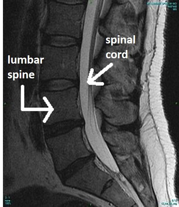 Solved Which mri are frontal, sagittal, and transverse. | Chegg.com