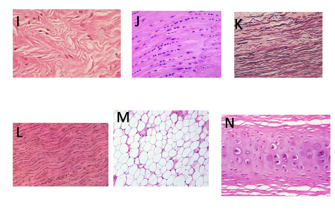 Solved Please identify the connective tissues in the images | Chegg.com