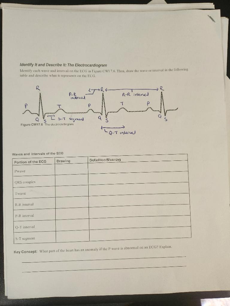 Solved Identify It And Describe It: The Electrocardiogram | Chegg.com