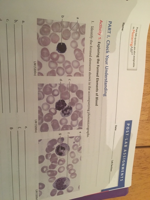 solved-exploring-the-formed-elements-of-blood-identify-the-chegg