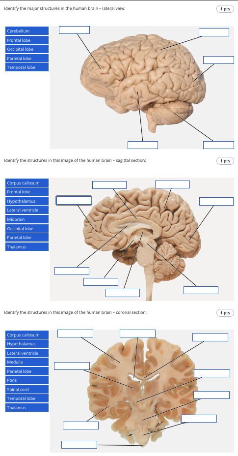 Solved Identify the major structures in the human brain - | Chegg.com