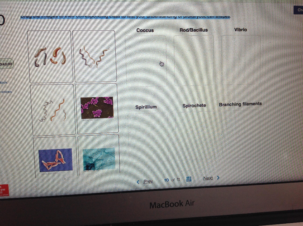 Solved Chi Coccus Rod/Bacillus Vibrio Branching filaments | Chegg.com