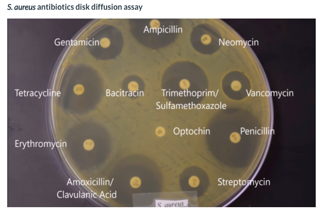 Solved E. coli antibiotics disk diffusion assay Ampicillin | Chegg.com