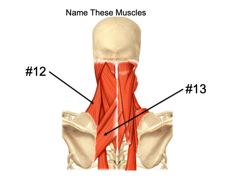 Solved Name These Muscles #12 #13 | Chegg.com