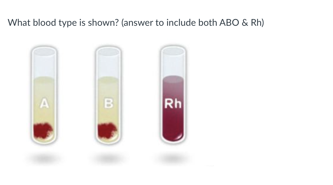 Solved What Blood Type Is Shown? (answer To Include Both ABO | Chegg.com