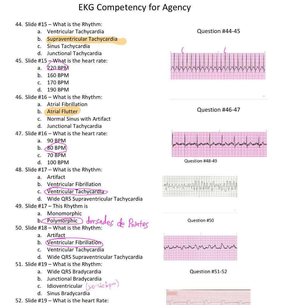 Solved EKG Competency For Agency Question #44-45 Question | Chegg.com