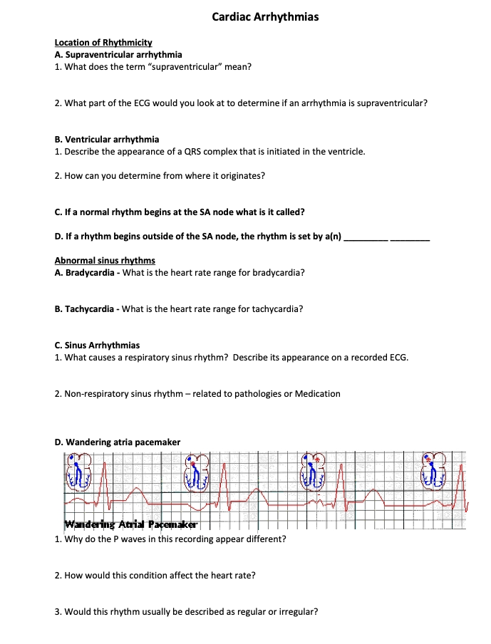Question Cardiac Arrhythmias Location Of Rhythmicity A
