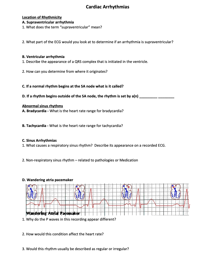 Question: Cardiac Arrhythmias Location Of Rhythmicity A ...