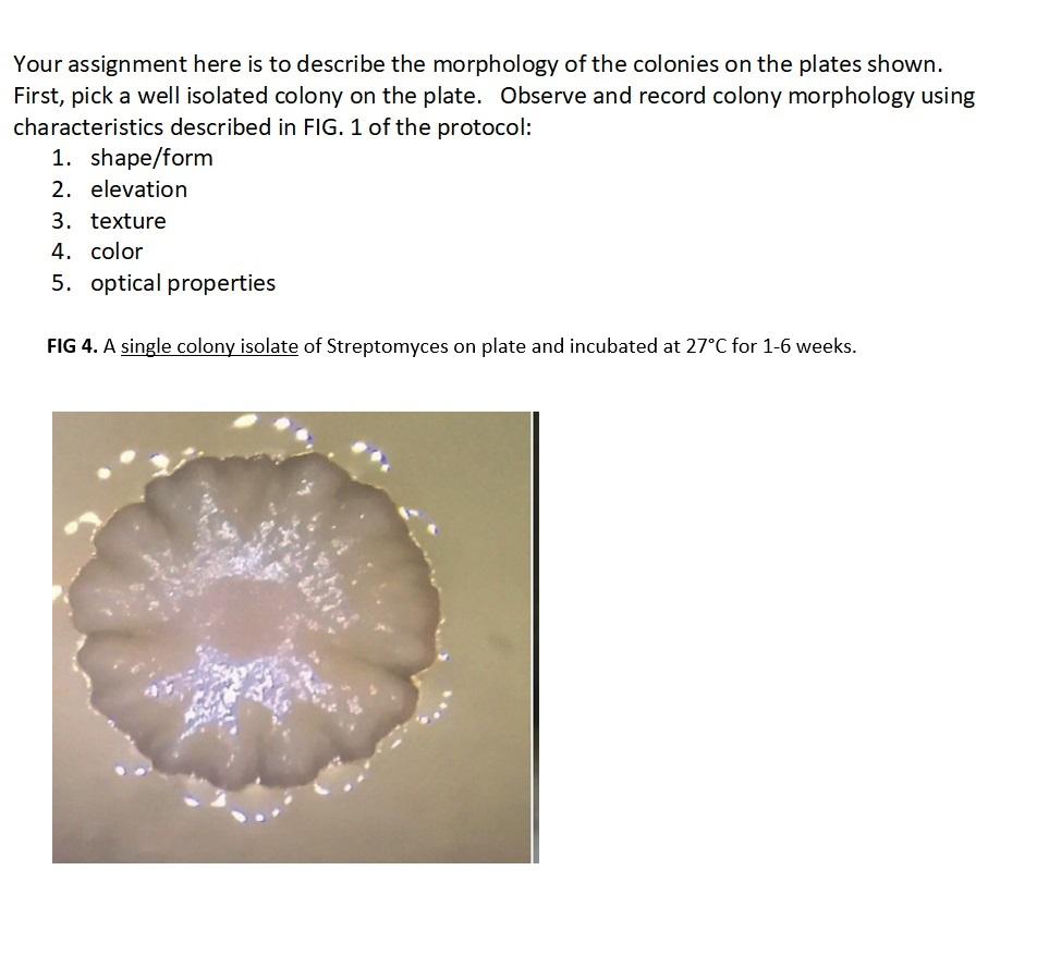 lour assignment here is to describe the morphology of the colonies on the plates shown. First, pick a well isolated colony on