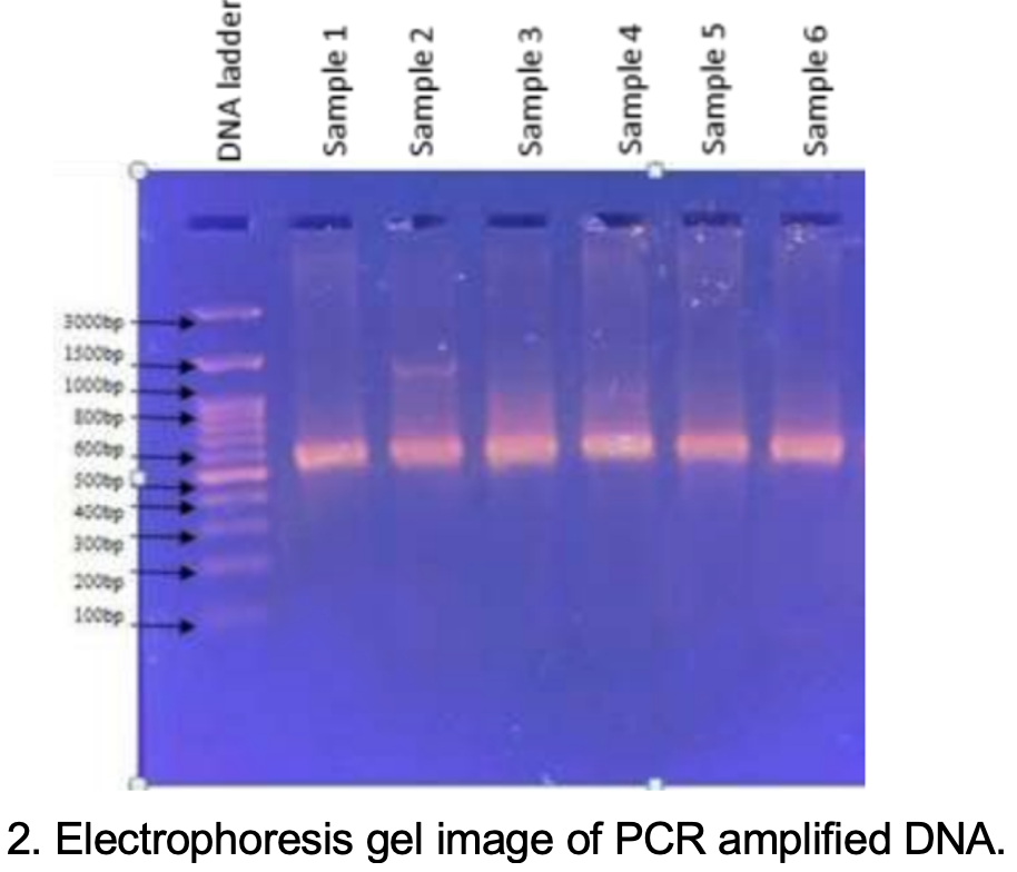 Solved 10,000 bp Electrophoresis gel image of genomic DNA | Chegg.com