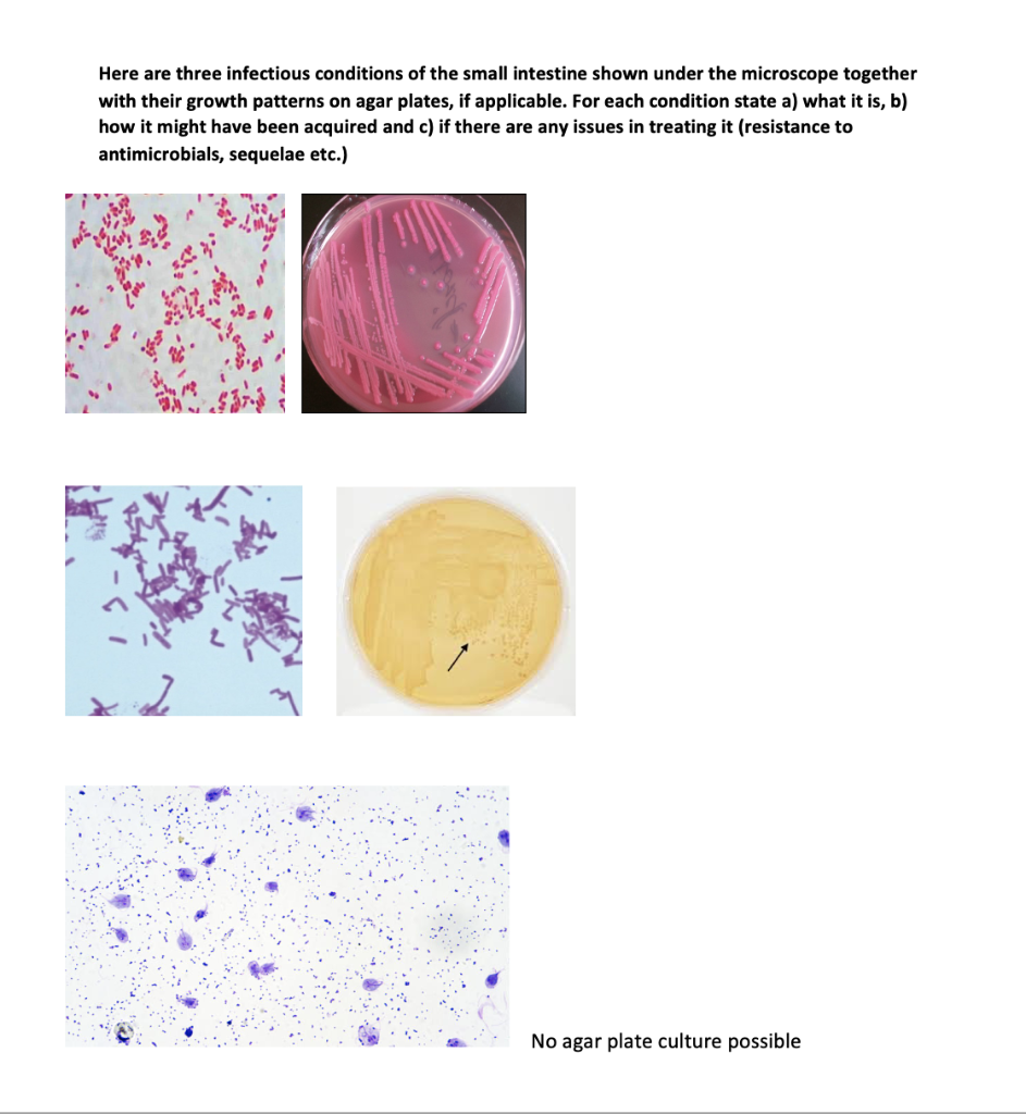 Solved Here are three infectious conditions of the small | Chegg.com