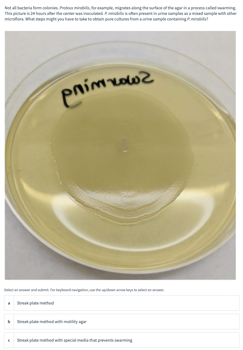 proteus mirabilis swarming motility