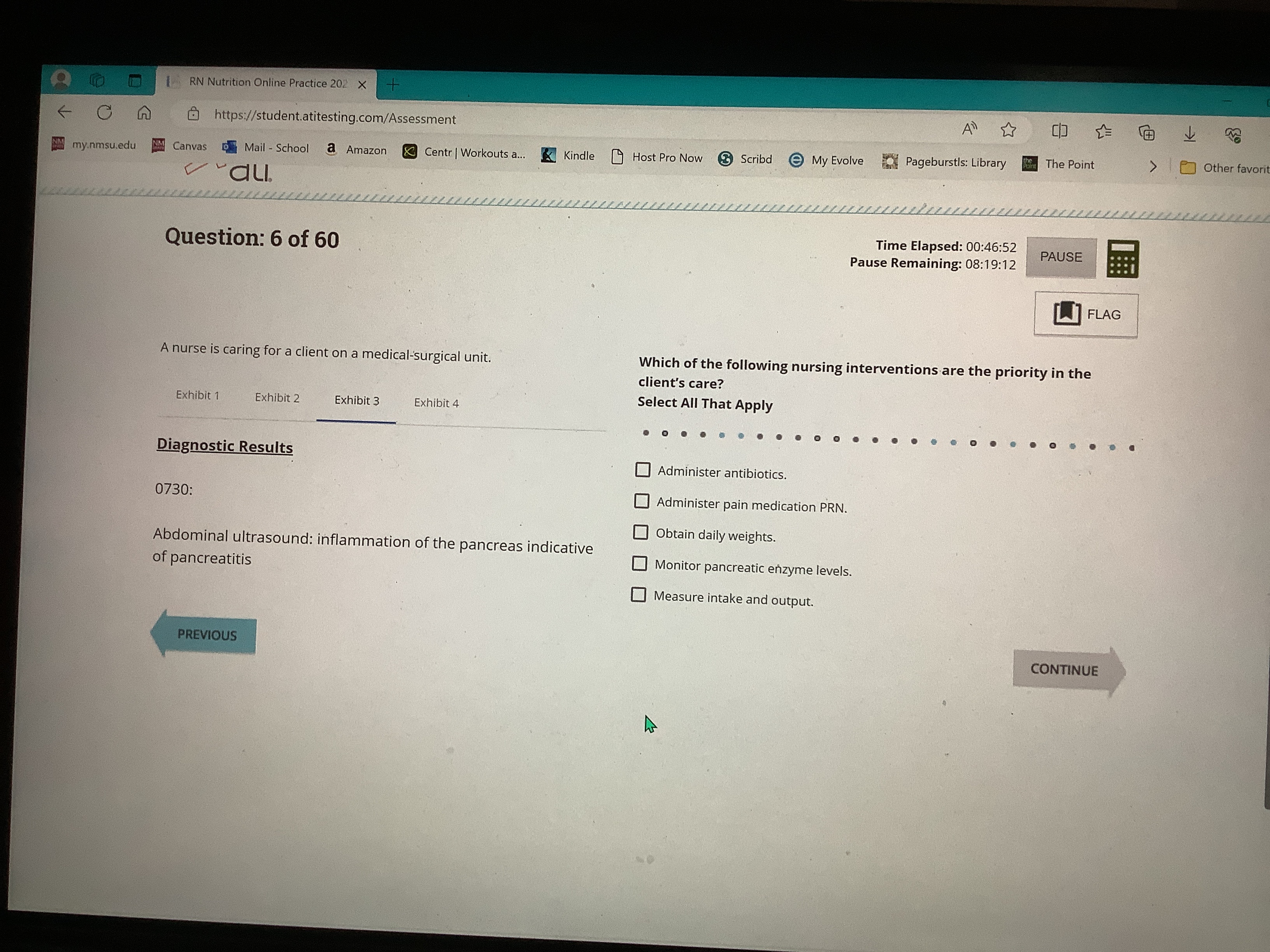 Solved Question: 6 ﻿of 60A nurse is caring for a client on a | Chegg.com