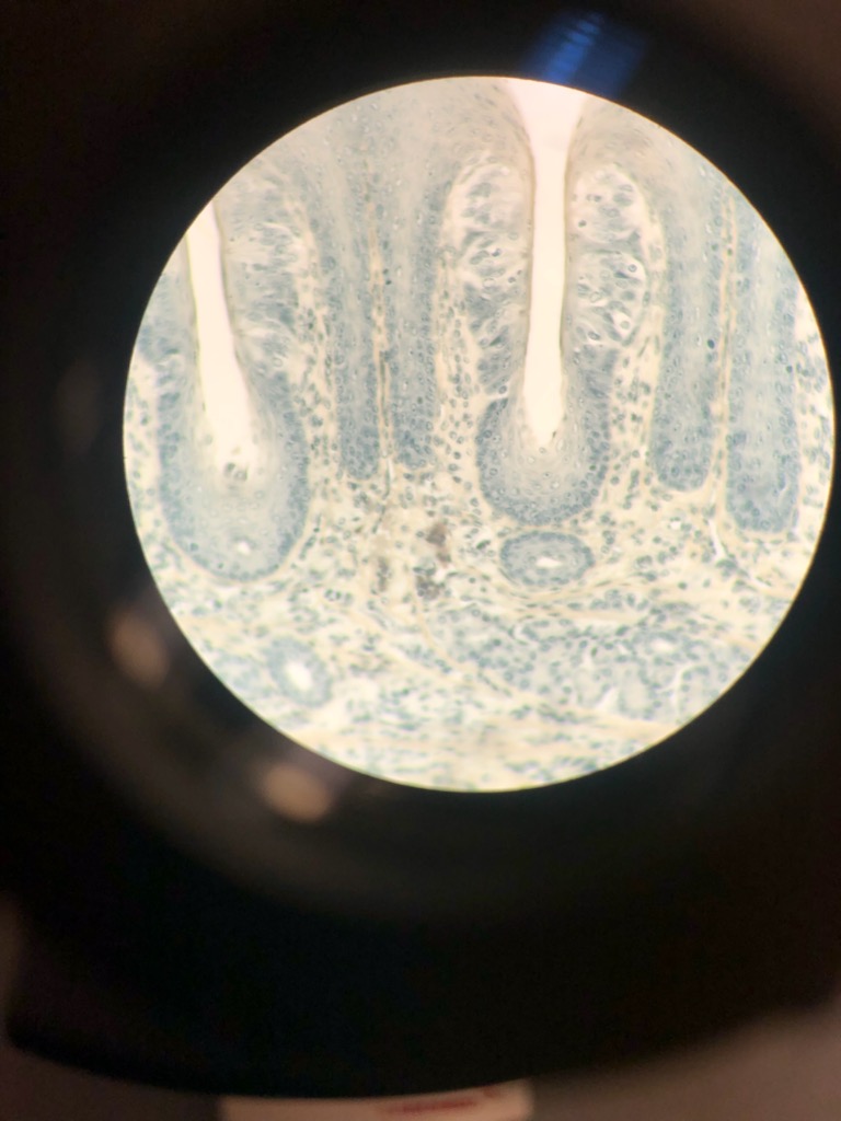 Solved The picture attached is a Taste Buds Tongue from a