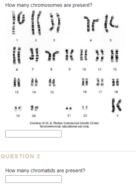 Solved How Many Chromosomes Are Present Tril 3 10 11 1 Chegg Com