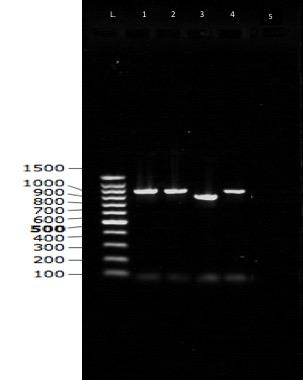 Solved 100% Results - Colony PCR Vector Specific Lane # L 1 | Chegg.com