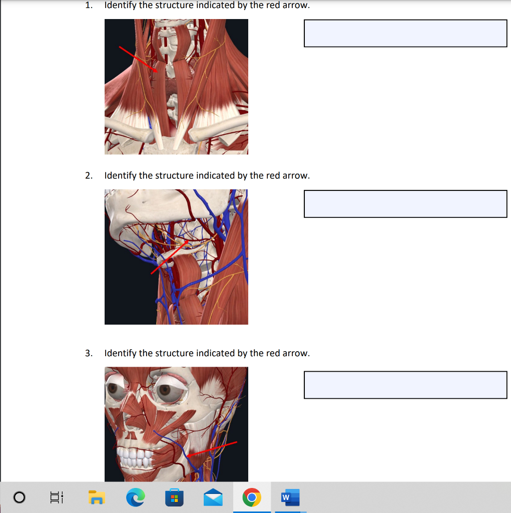 Solved 2 Identify The Structure Indicated By The Red Arrow