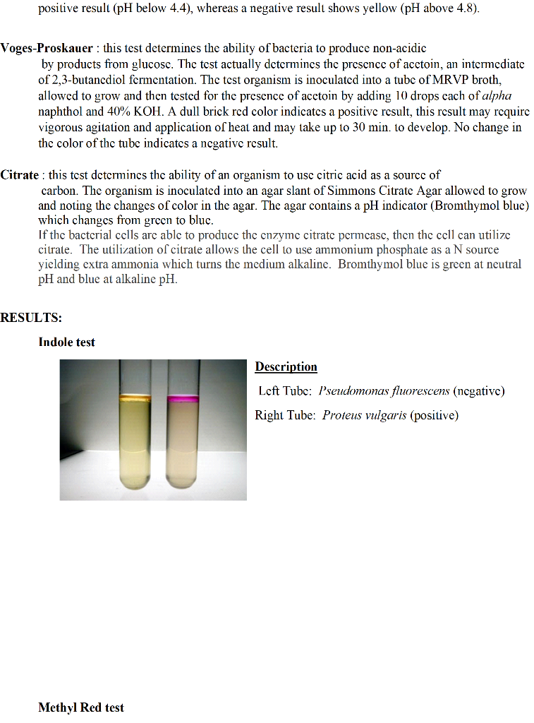 solved-lab-17-imvic-the-imvic-is-a-scrics-of-four-tests-chegg