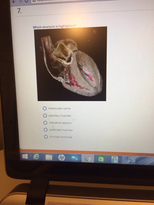Solved Which structure is highlighted? trabeculae carne