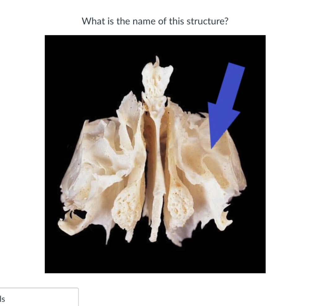 Solved What is the name of this structure? Is | Chegg.com