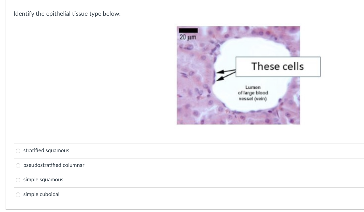 Solved Identify the epithelial tissue type below: stratified | Chegg.com