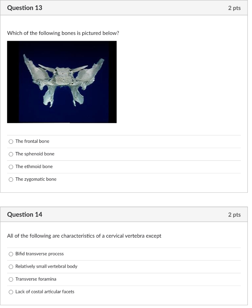Question 13 2 pts Which of the following bones is pictured below? The frontal bone The sphenoid bone The ethmoid bone The zyg