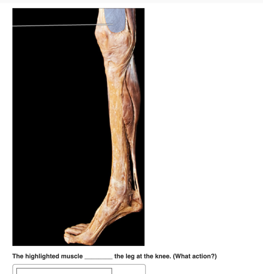 Solved The highlighted muscle the leg at the knee. (What | Chegg.com