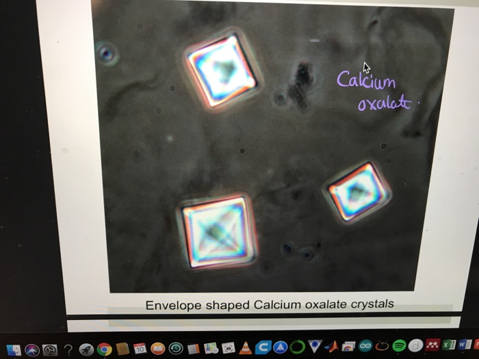 calcium oxalate stones envelope