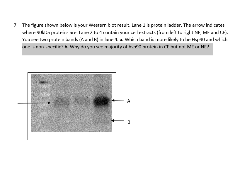 Solved The Figure Shown Below Is Your Western Blot Result. | Chegg.com