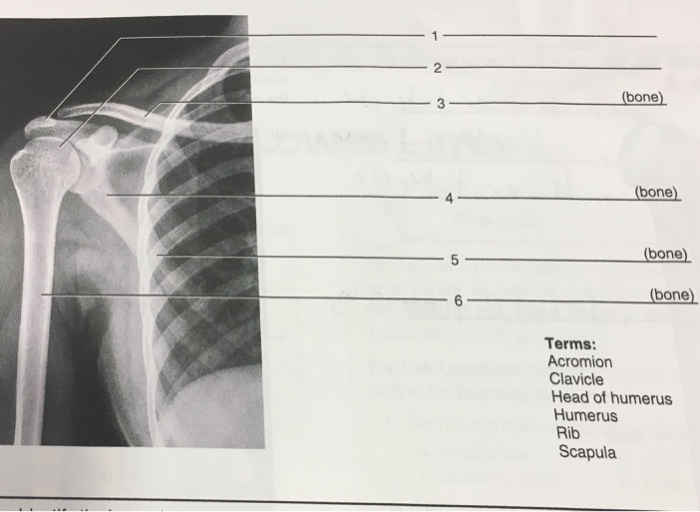 Solved 5 2 7 8 3 Terms: Costal cartilage of false rib Costal | Chegg.com